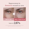 Sérum para ojos Medicube, ADN de salmón, PDRN y péptidos