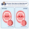 TRUSTV Electronic Tonsil Stone Remover - 9PCS Tonsil Stone Removal