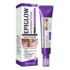 Houkea Crema De Retinol Cuidado Suave De La Cara, Tono