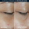 RoC Multi Correxion Revive + Glow Eye Balm | With