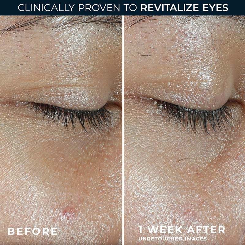 RoC Multi Correxion Revive + Glow Eye Balm | With