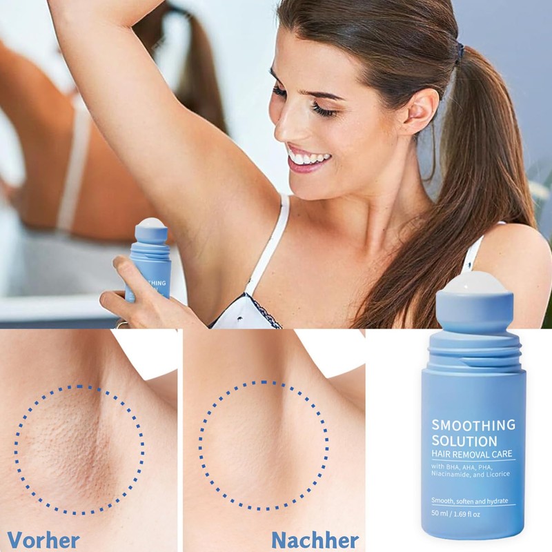 Smoothing Solution Ingrown Hair Care Roll On, Ingrown Hair Roller