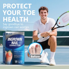 Ingrown Toenail Treatment 1Kit, Ingrown Toenail Corrector Tool, Professional At-Home Correction Strips with Titanium Alloy for All Foot Sizes, Lasting Results in 4-6 Weeks