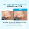 TONYMOLY Tako Pore Blackhead Scrub Stick