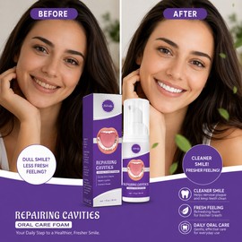 Teeth Cleaning Gel Kit for Daily Oral Care – Gentle Whitening Support for a Brighter Smile Routine