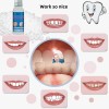 Brand: YILUYUNI Tooth Repair Kit, Moldable Filling Dental Care Kit
