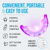 Starlite Smile Blue Light Red Light Gum Light, Periodontal Light,
