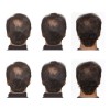 Racotex Locion Para Crecimiento De Pelo Y Barba 100% Efectivo