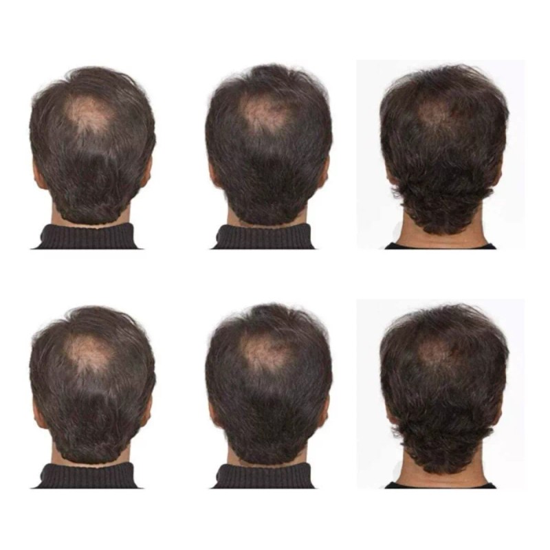 Racotex Locion Para Crecimiento De Pelo Y Barba 100% Efectivo