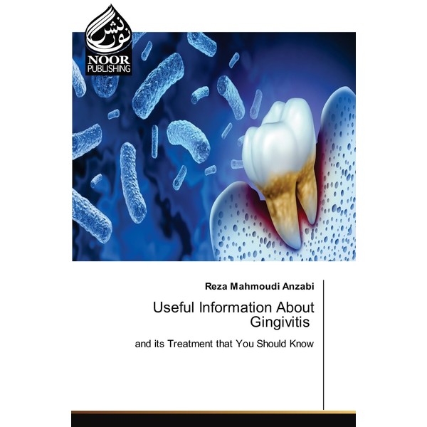 Useful Information About Gingivitis: and its Treatment that You Should