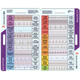 EKG Rhythm Interpretation - Compact & Portable Reference Card – Rapid Interpretation Guide – Dual Horizontal & Vertical Layout