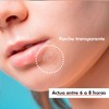 Simple Pimple - Pickelpflaster, Pimple Patches mit Salicylsäure, Teebaumöl, Akne,