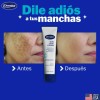 Crema Anti Manchas Dermisa Vitamina Rostro 50ml