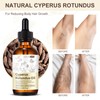 XINSZLIN Cyperus Rotundus Oil for Hair Removal, Cyperus Rotundus Oil