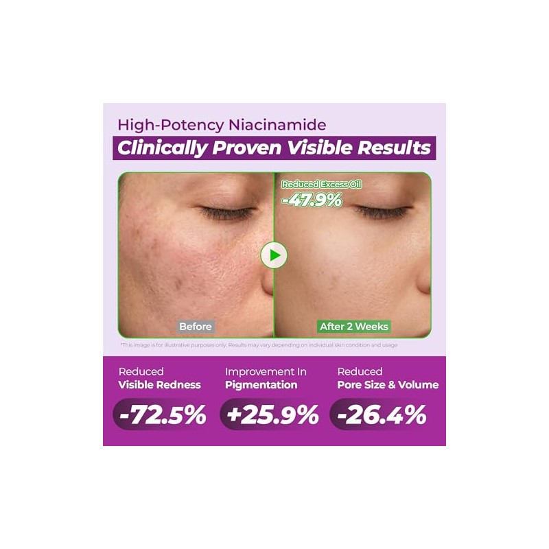 JUMISO Niacinamide 10 Serum - Korean Face Serum with Glutathione,