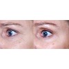 Matrixyl 3000 Peptide Face Cream with Hyaluronic Acid, Retinol, Collagen