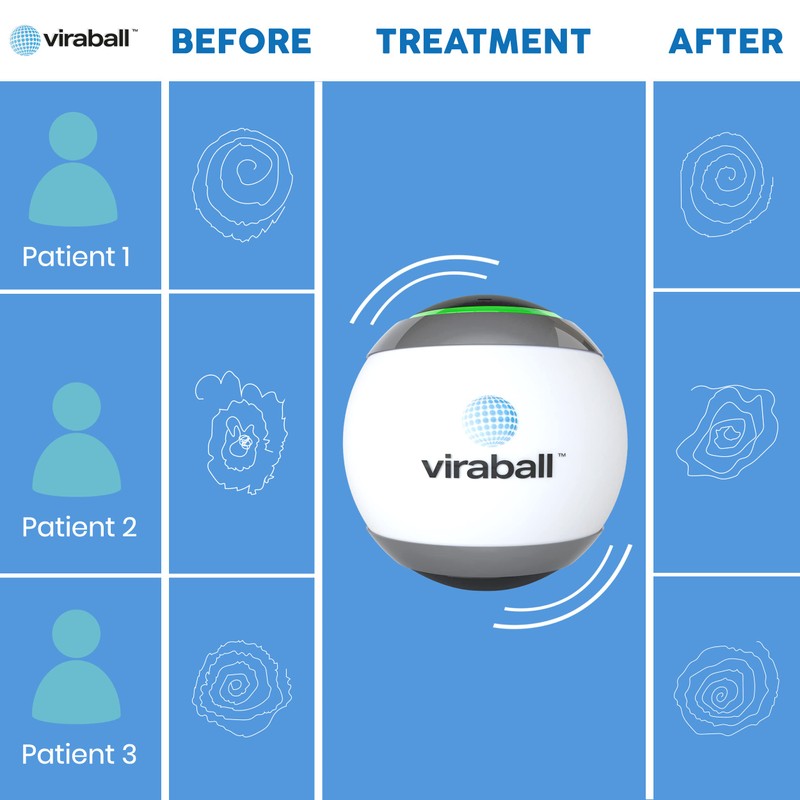 viraball Physiotherapy Vibration Therapy Ball - Physical Therapy for Hand