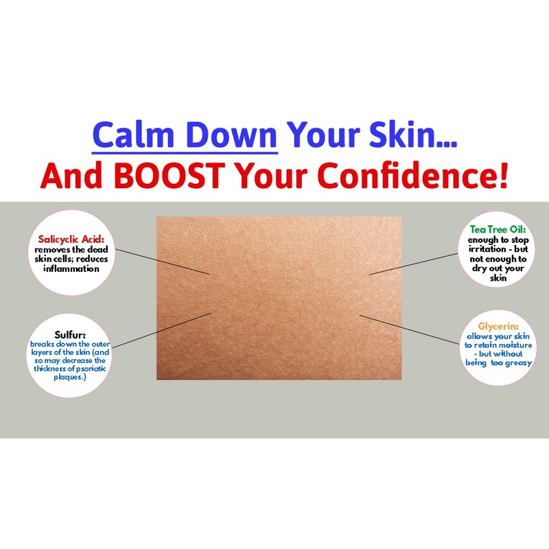 V66 Psoriasis Treatment Cream UK Made Paraben and Cruelty Free
