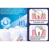 Gomia Kit De Blanqueamiento Dental