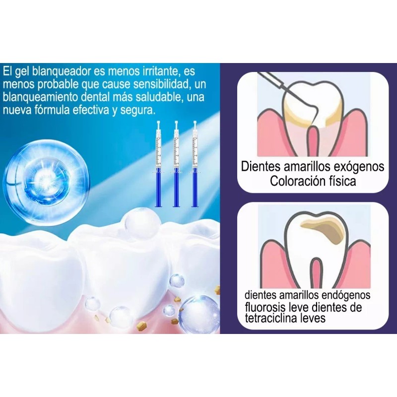 Gomia Kit De Blanqueamiento Dental
