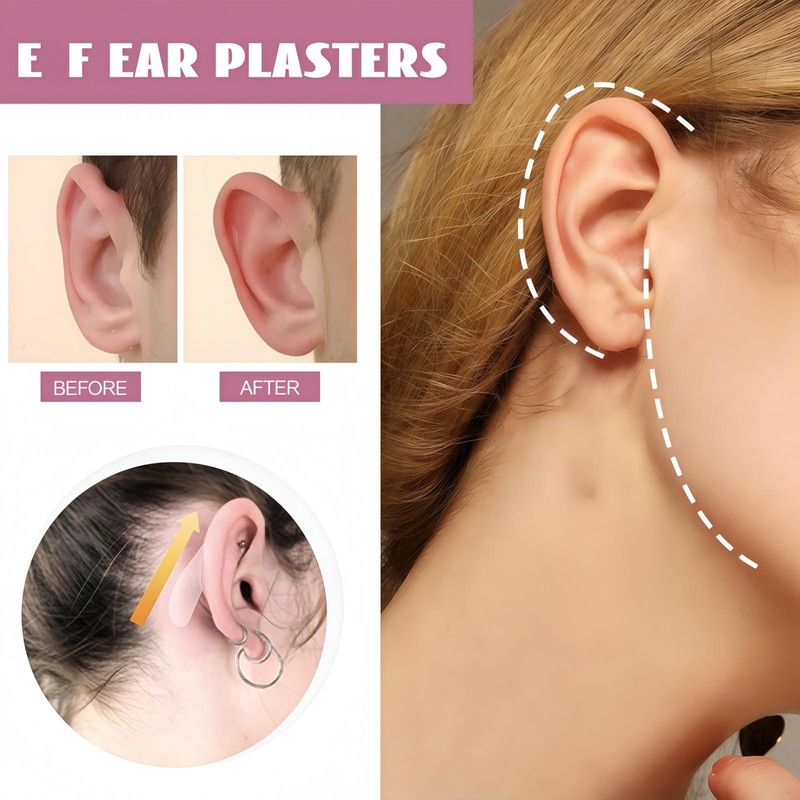 30PCS Cosmetic Ear Corrector,Solve Big Ear Problem with E-ar Stickers,E-ar