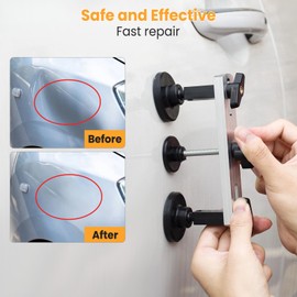 Sigoobal Sigoobal Dent Puller, Paintless Dent Removal Kit C All-in-One Car Dent Puller Kit with Bridge PullerCDent Repair for Hail, Dings