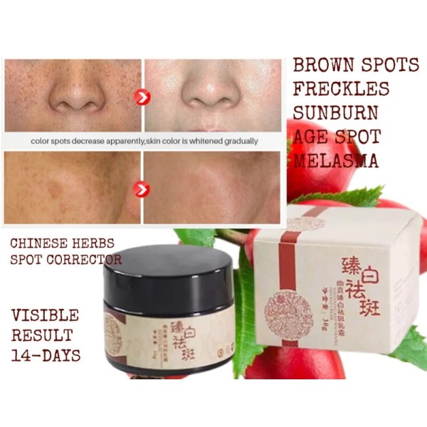 Unbranded Natural Herbal Plant Extract Freckle Dark Spot Removal Cream
