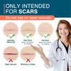 MEDLOT Silicone Scar Sheets, 1.55” x 156” - 4M, Medical