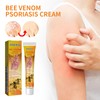 Wellness South Moon Anti-Itch Bee Venom Psoriasis Cream Cooling Soothing