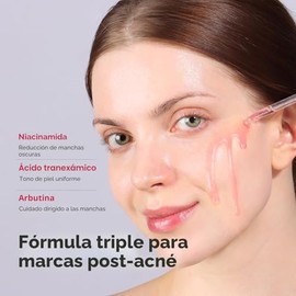 TOSOWOONG Suero de Niacinamida 10% + Ácido Tranexámico 4%, Arbutina 2%, Ácido Hialurónico, Suero Facial TXA, Piel de Vidrio, Clarificante, Complejo Radiante con Color Natural, Cuidado de la Piel