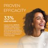Vitamin C 1000mg – High-Strength Chewable Tablets for Energy, Immune
