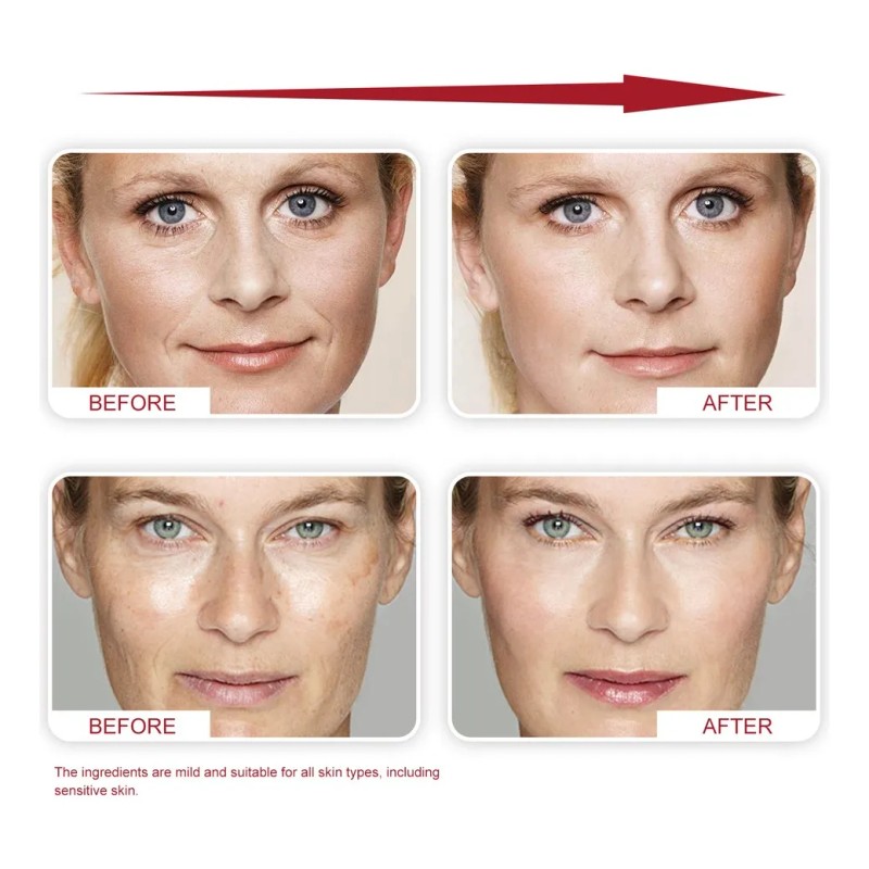 Crema Antiarrugas Facial Hidratante Diaria