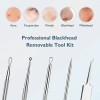 Unbranded Blackhead Remover Tool Kit with Diagonal Tweezers - Pimple