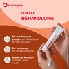 Clotrimazole AL 1% Cream 50 g, 50 g