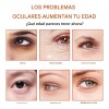 La Crema Para Ojos Con Retinol Mopoyat Hidrata Y Reafirma
