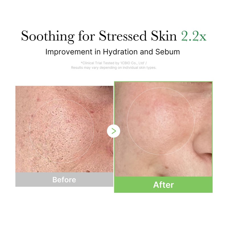 medicube Exosome Cica Tea Tree Cream for Sensitive Skin with