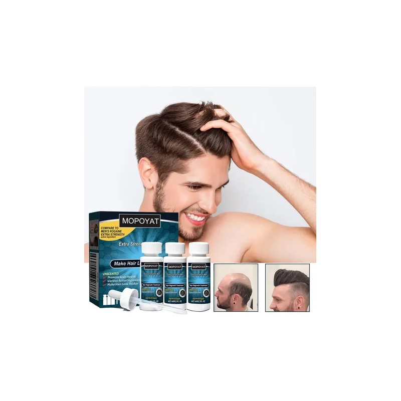 Pack de 3 Esencias Anticaída MOPOYAT para Hombre con Extra