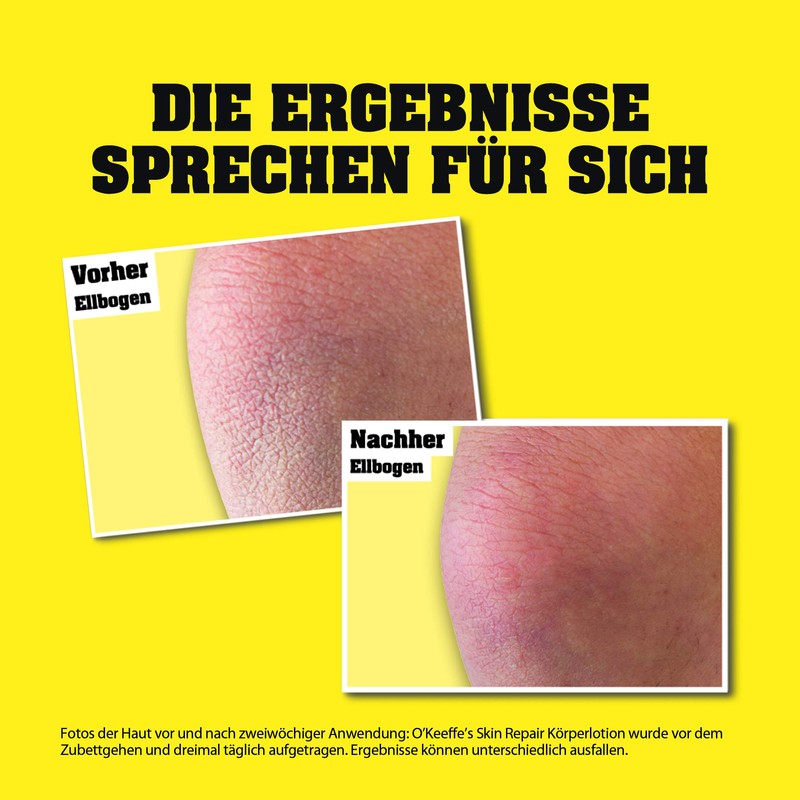 O'Keeffe's Skin Repair Body Lotion Pump Dispenser, 325 ml