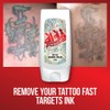 INKED UP TATTOO REMOVAL CREAM – FAST WORKING TATTOO REMOVE