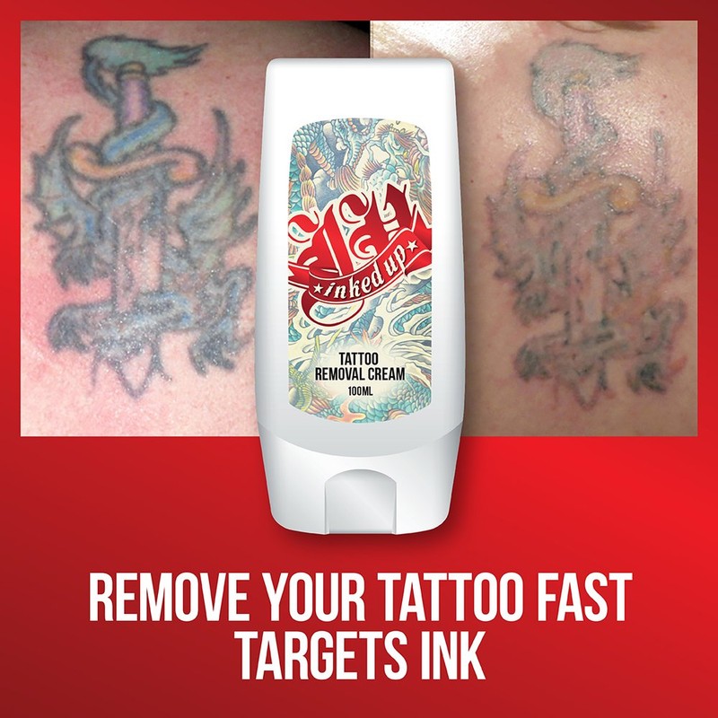 INKED UP TATTOO REMOVAL CREAM – FAST WORKING TATTOO REMOVE
