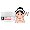 Mascarila Acni Off 100g Anti Acne Grasa