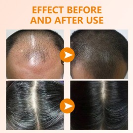 YAFUSIPE 2 Pack Ginger Hair Regrowth Shampoo Bar Turmeric Soap for Hair Growth Natural Ginger Solid Bars for Thinning Strengthen Curly Oily Hair Anti Hair Loss Travel Deep Cleansing Women Men 4.23OZ/120g