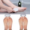 Myynti Foot Scrubber Stone for Dead Skin Remover for Dry