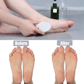 Myynti Foot Scrubber Stone for Dead Skin Remover for Dry Dead Skin, Heels, Elbows, Hand Foot Care (Pack of 1)