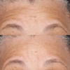 Perricone MD Hypoallergenic Clean Correction Barrier Repair Nourishing Moisturizer, 2