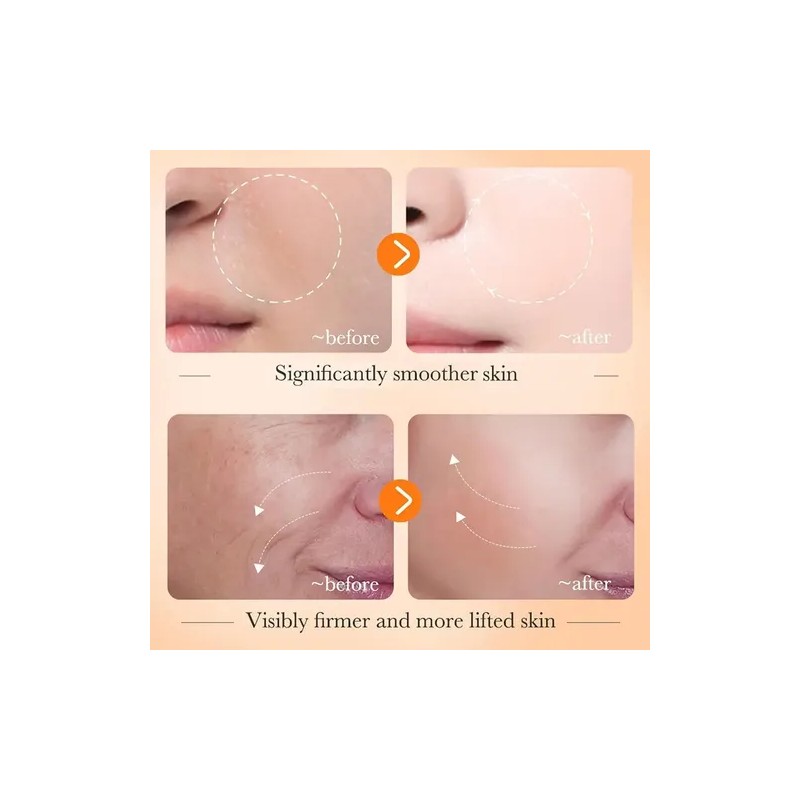 Serum Facial Vitamina C Antioxidante Brillo Antiacne Bioaqua Todo Tipo