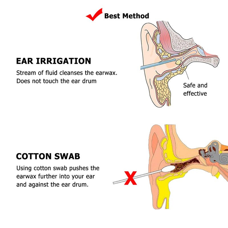 Ear cleaning kit Ear Wax Removal Tool Water Washing Syringe