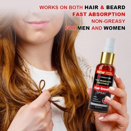 Hair Growth Spray by Ceessting- Biotin, Caffeine and Niacinamide - Anti-Hair Loss for Thinning Hair -Hair Regrowth Treatment for Men and Women- 2 Ounces