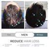DS Laboratories Hair Loss Booster Bundle (Proactive & Reparative for