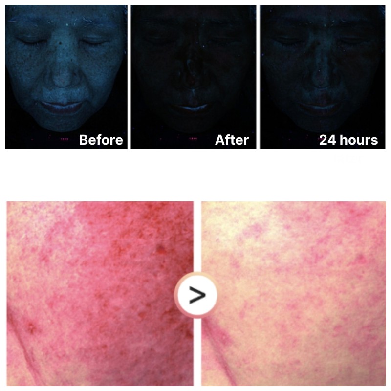 AROCELL Mela TXA Sun Serum SPF50+ PA++++ 40ml, Type:40ml*1